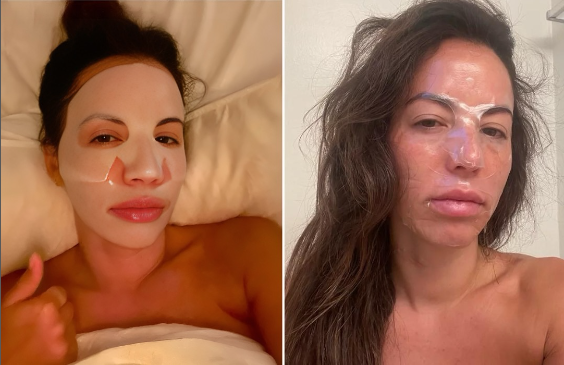 BiocollagenPlus - Máscara absorvível de colágeno + ativos do botox - Frete grátis + Brinde Exclusivo